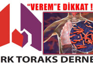 Türk TORAKS Derneği: Veremden Ölümler Artacak