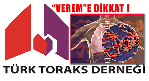 Türk TORAKS Derneği: Veremden Ölümler Artacak