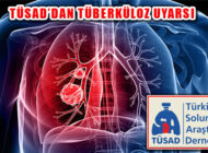 TÜSAD Uyardı, ‘Tüberküloz Halen Önemli Bir Sağlık Sorunu’