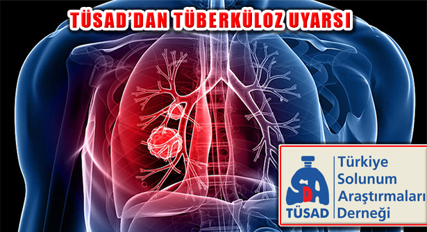 TÜSAD Uyardı, ‘Tüberküloz Halen Önemli Bir Sağlık Sorunu’